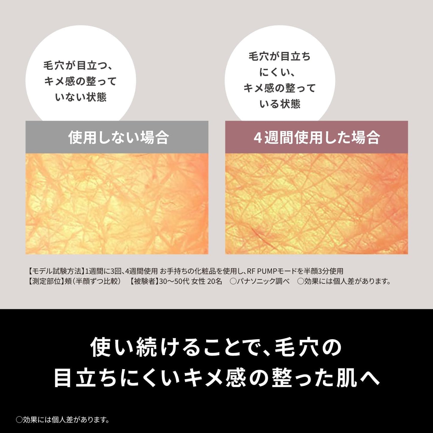 Panasonic - 樂聲 EH-SR86 Vitalift RF美容儀 四合一美容儀 (RF EMS LED和離子)【平行進口】