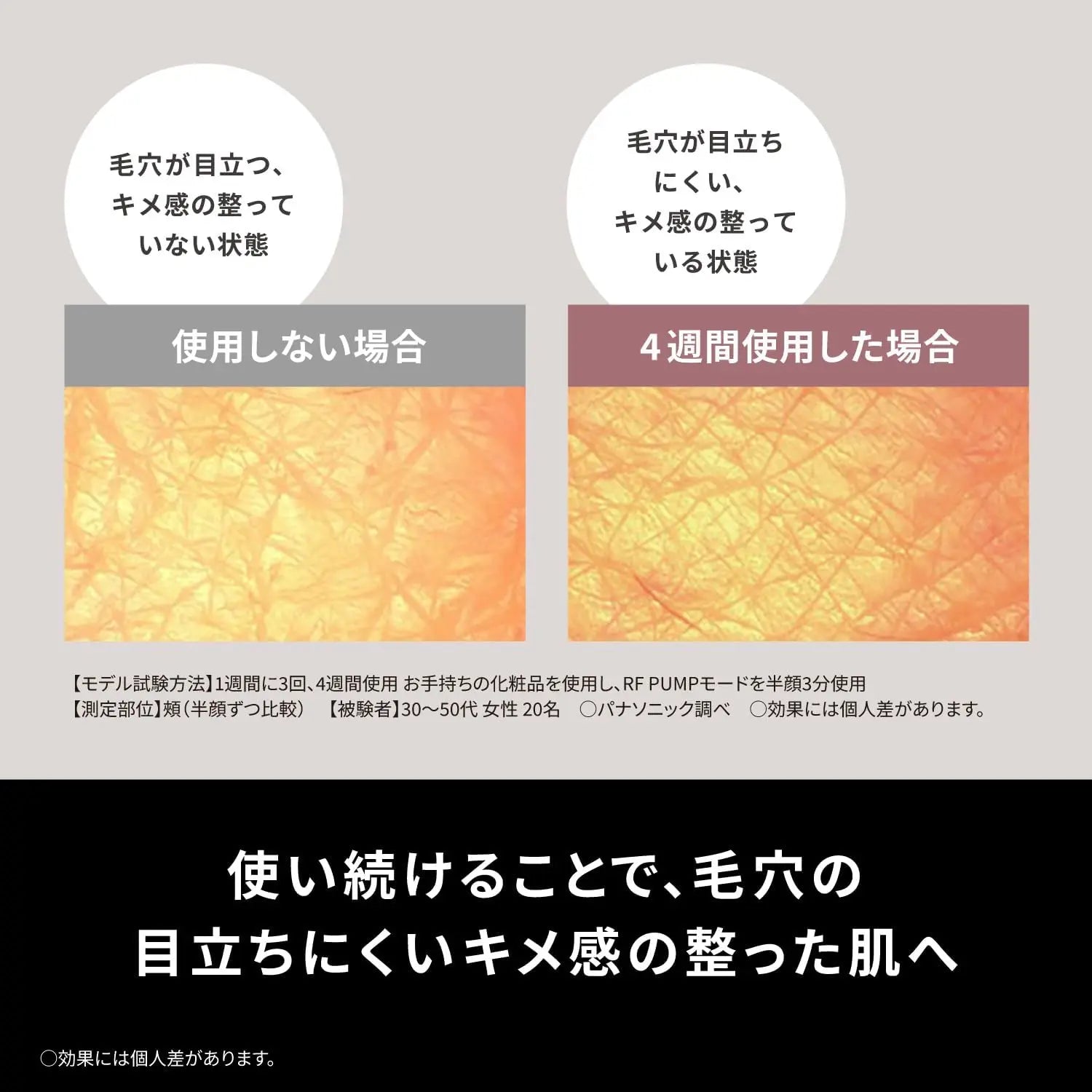 Panasonic - 樂聲 EH-SR86 Vitalift RF美容儀 四合一美容儀 (RF EMS LED和離子)【平行進口】