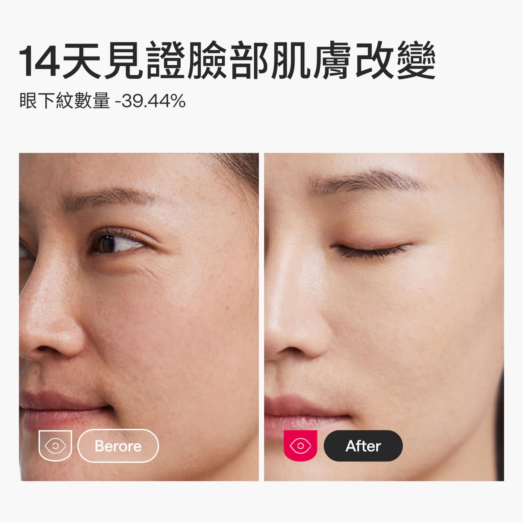 Ulike - 白皇后 LED美容面膜儀【香港行貨】